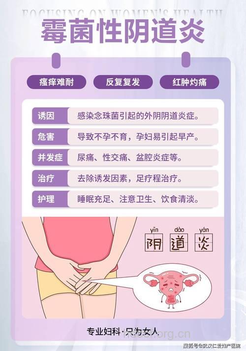 如何确诊霉菌性阴道炎