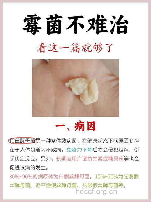细菌性阴炎严重吗 能根治吗