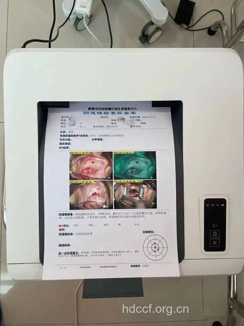 阴道镜检查痛吗 疼痛不明显可以忍受