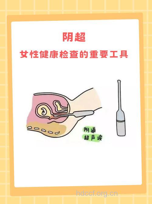 阴超检查什么时候做最好 与检查目的有关