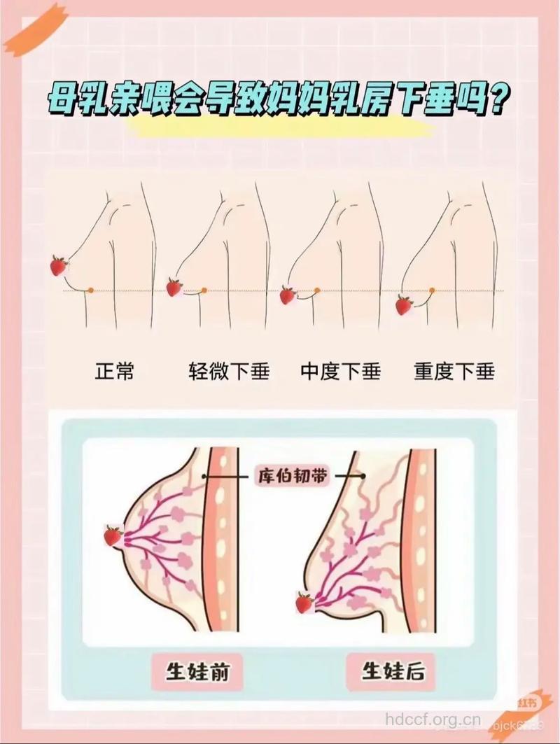 导致女人乳房下垂的原因