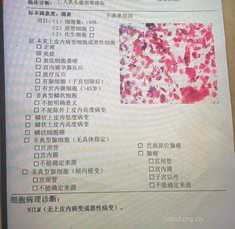 宫颈TCT检查结果有哪几种