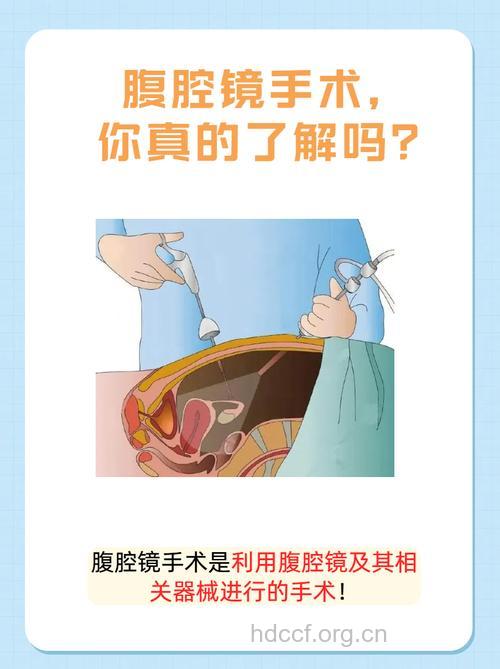 腹腔镜是诊断内异症的有效方法