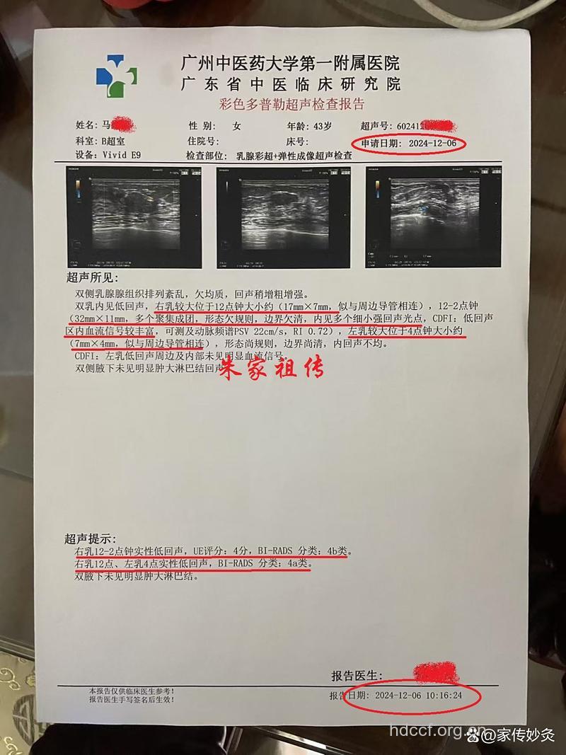 乳腺彩超可以明确肿块性质