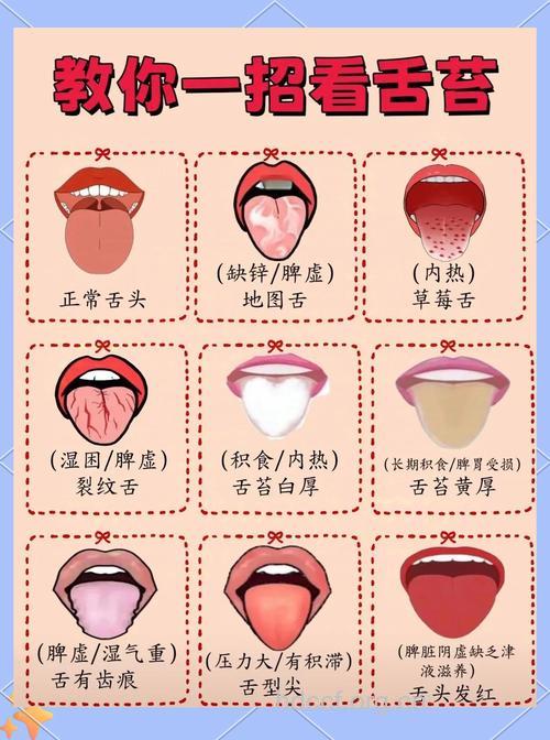 舌头告诉你是否健康