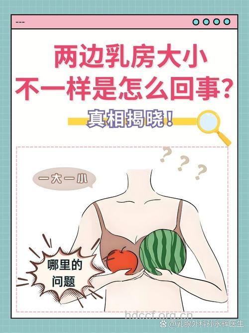 两侧乳房不对称是怎么回事