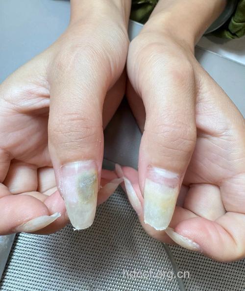 女人指甲太长易招来妇科病