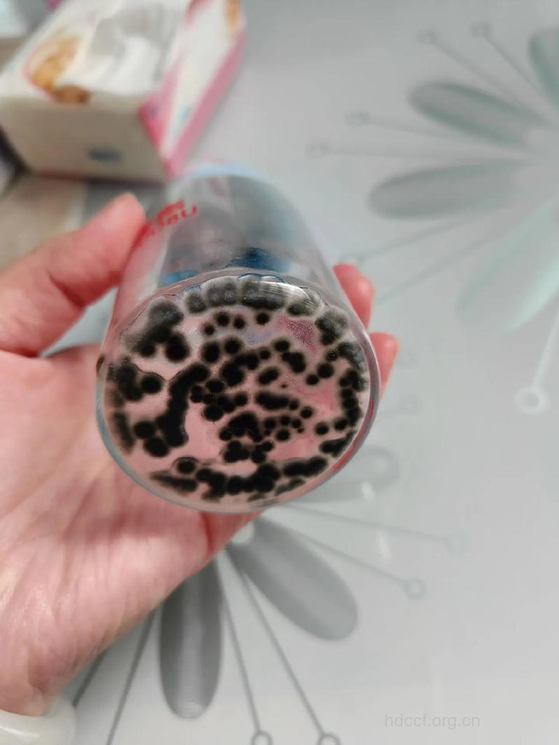 女人身边隐藏的的七大细菌温床