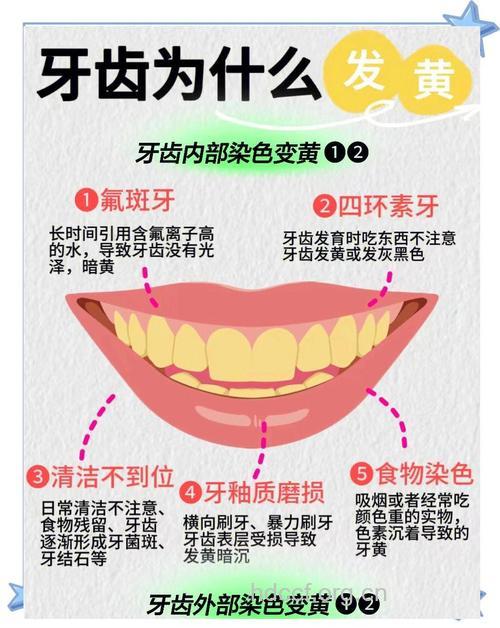 什么原因导致牙齿变黄