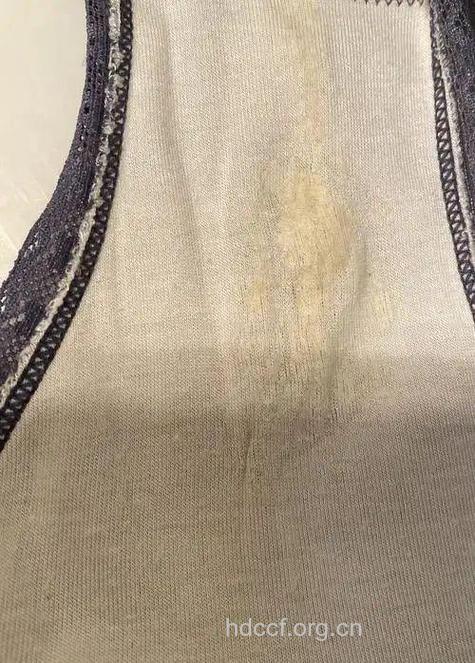 从女人内裤上可以看到的病