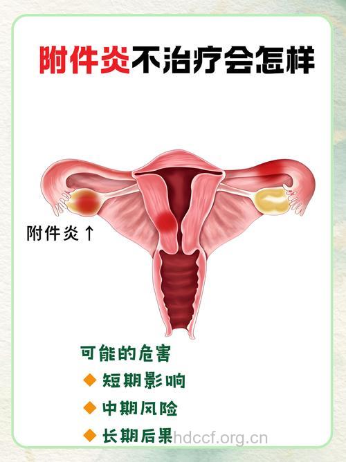 流产后护理不当会引起附件炎