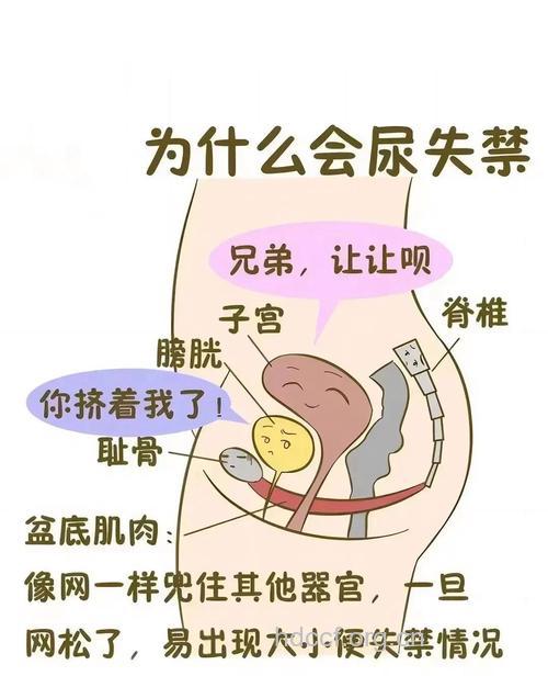 尿失禁的几种症状特征