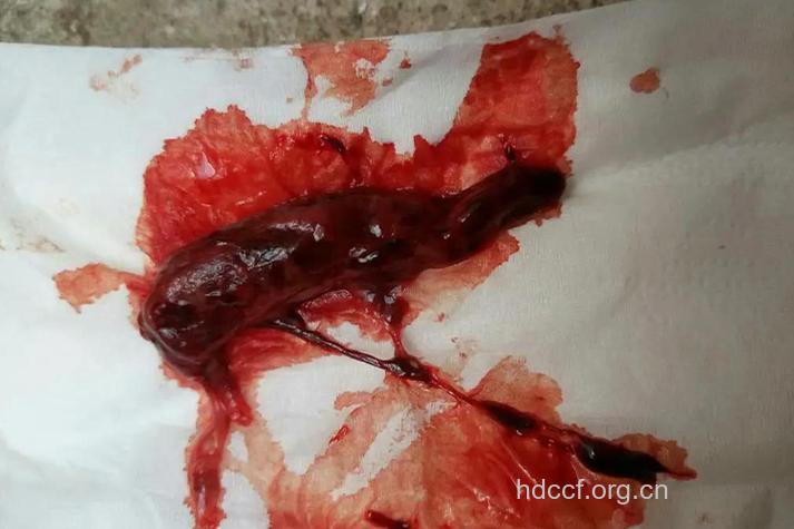 流产后出血的情况