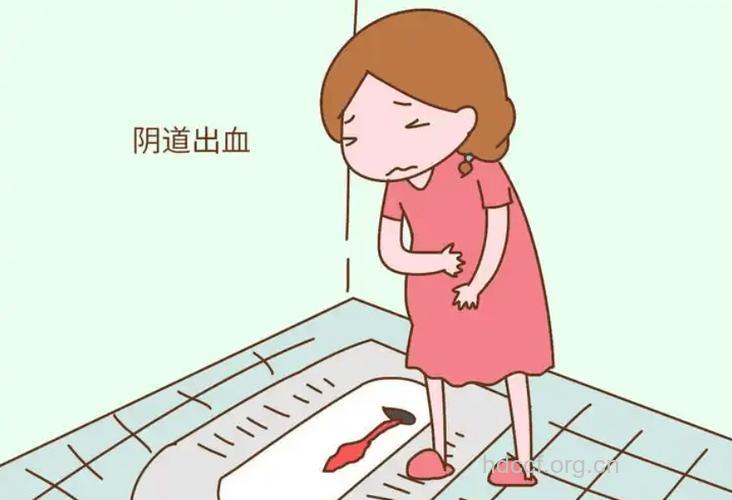 哪些病会导致阴道出血