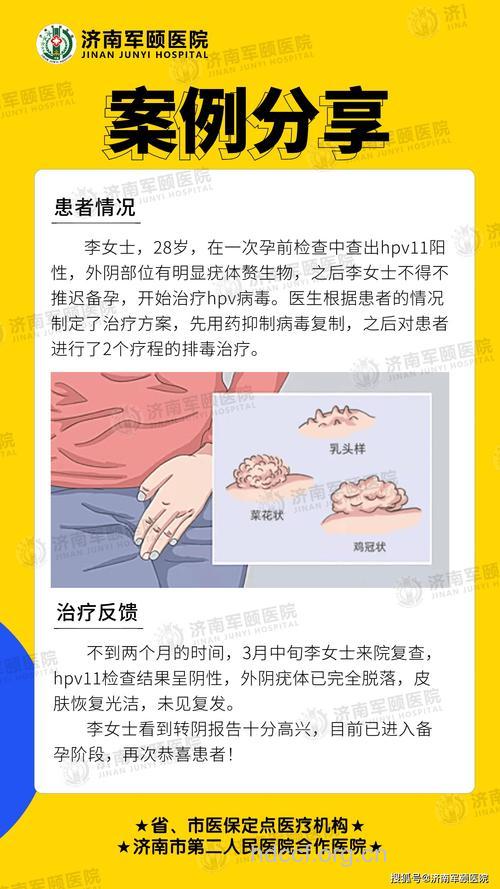 女性外阴尖锐湿疣能治好吗 治愈率很高