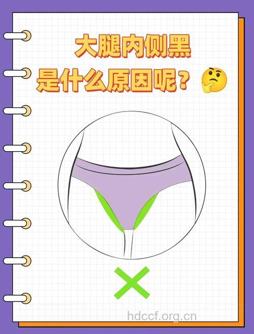 女人身体容易变黑的三个部位