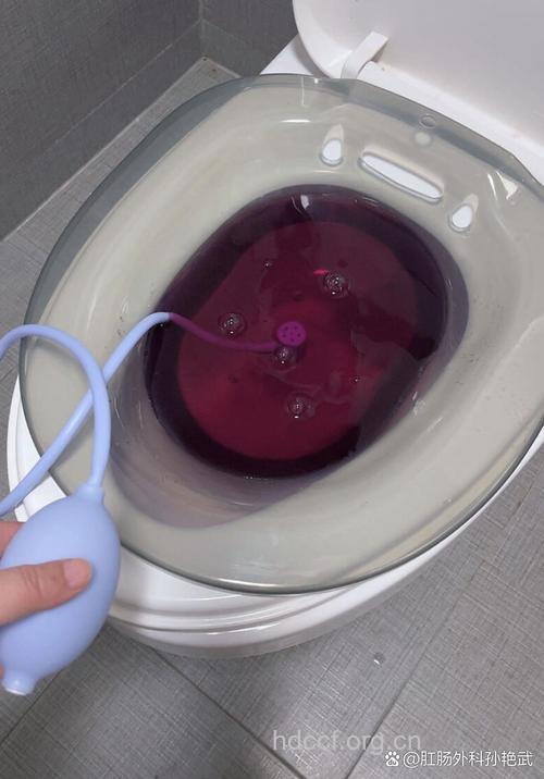 前庭大腺囊肿坐浴：用1∶5000高锰酸钾溶液坐盆