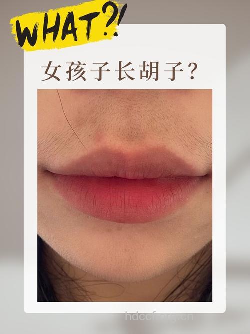 女人下巴长胡须是怎么回事