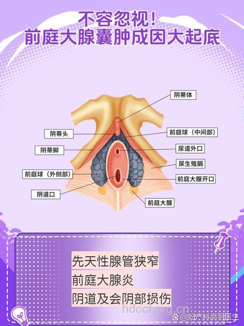 前庭大腺炎囊肿是什么？前庭大腺炎继发感染形成