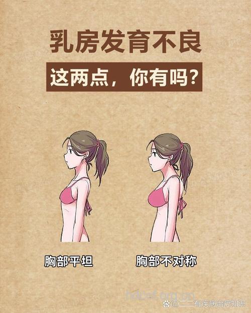 乳房发育不良怎么办？