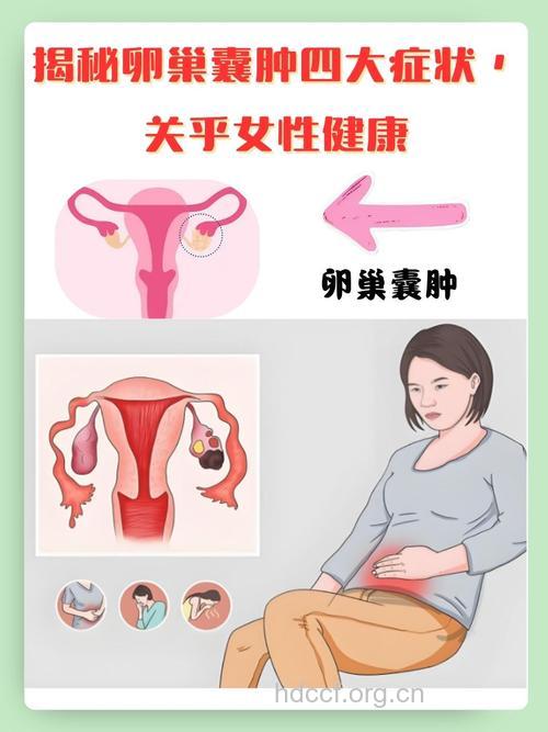 青春期女孩也可能患卵巢囊肿