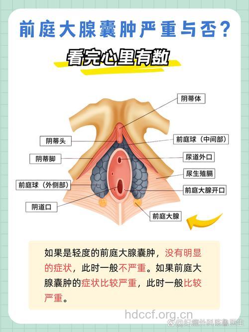 前庭大腺囊肿如何诊断 从3个方面鉴别