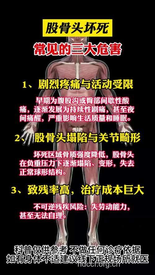 6个恶习严重伤害骨骼