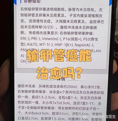 输卵管肿瘤严重吗 输卵管肿瘤有哪些危害