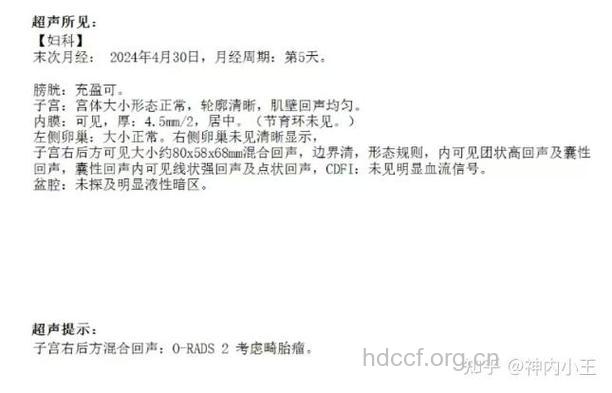 为什么会长卵巢畸胎瘤 如何检查确诊病情