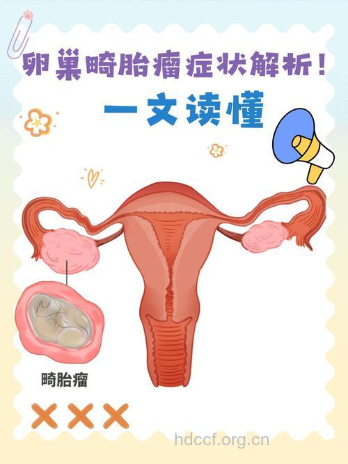 卵巢畸胎瘤是怎么引起的？主要有2个原因