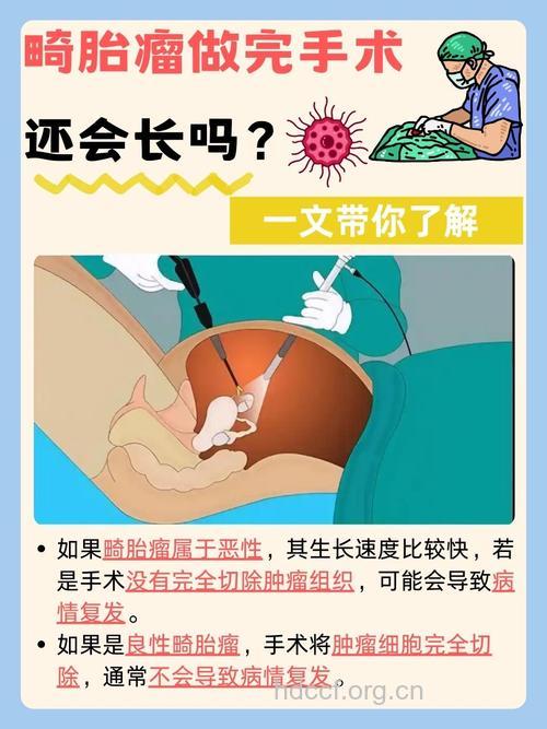 畸胎瘤有什么治疗原则