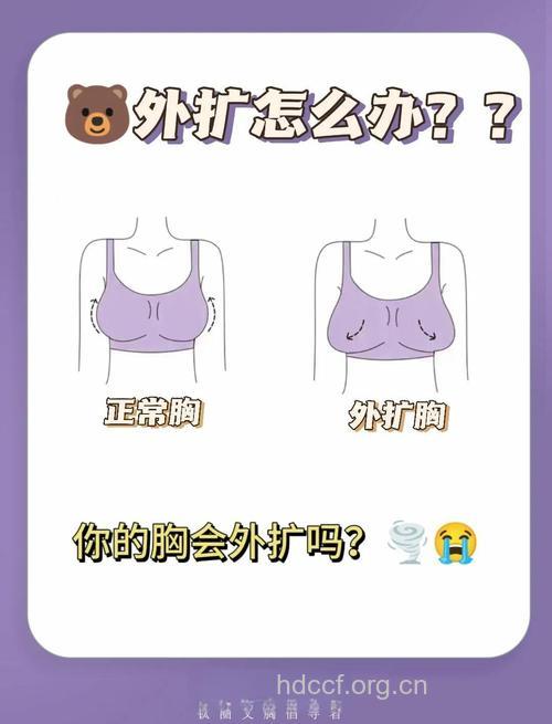 5个误区导致你的胸部外扩