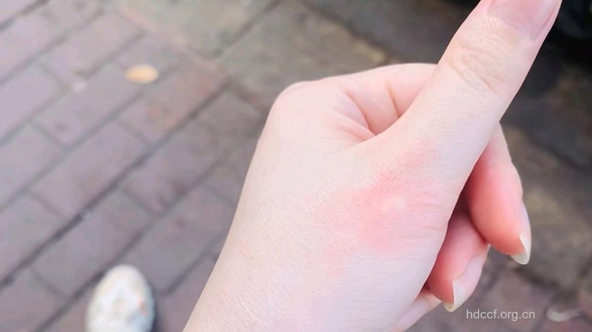 蚊子叮咬更爱叮化妆女性