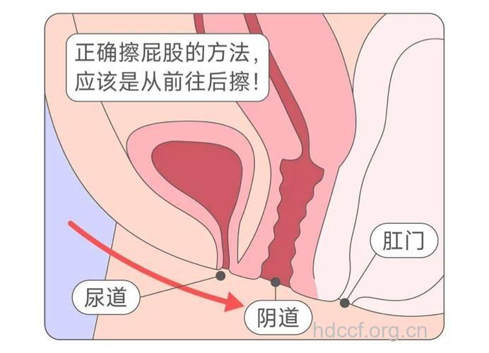 女人须小心阴道炎