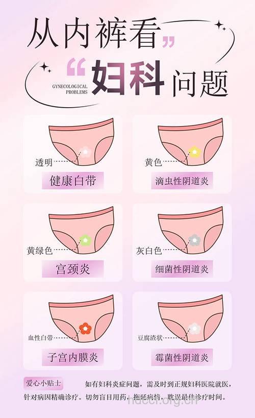 女人怎么区分正常分泌物