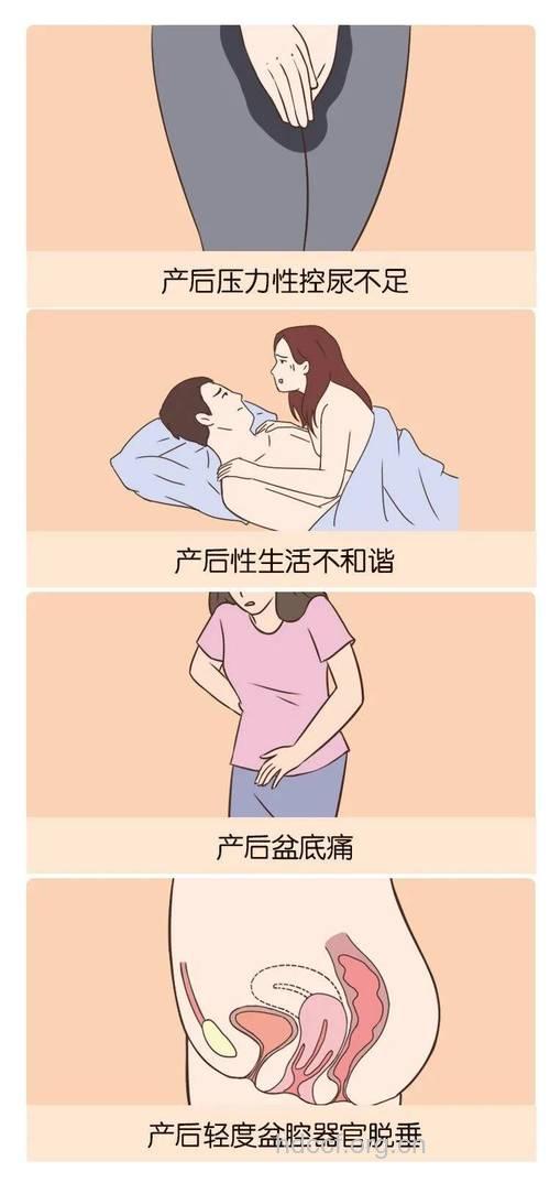 产后阴道恢复的方法