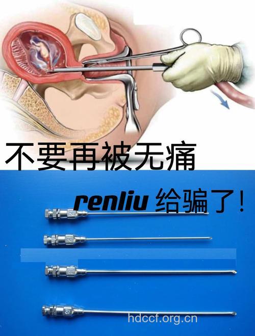 无痛人流真的无痛吗