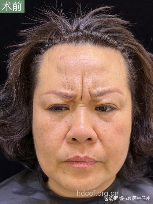 九大生活恶习让你狂长皱纹