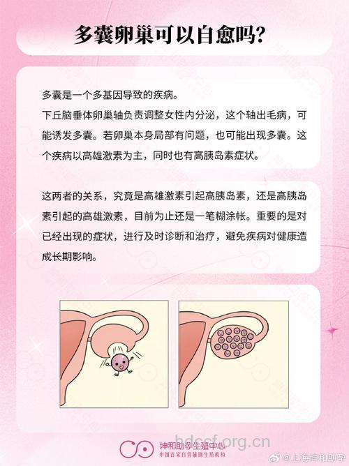 多囊卵巢可以怀孕吗