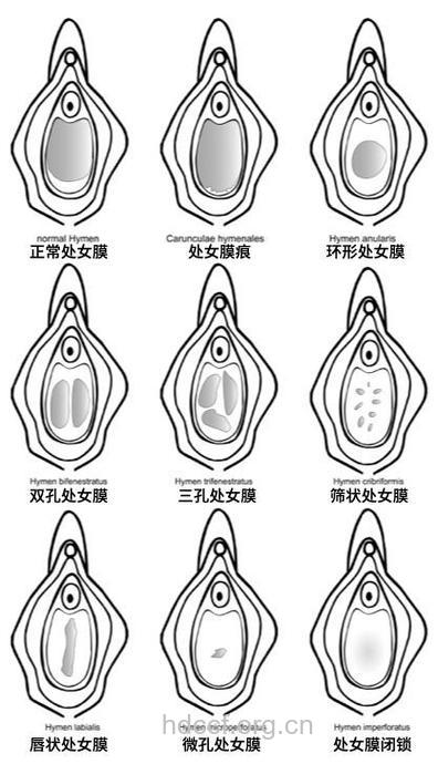 女性自慰 处女膜会破裂吗