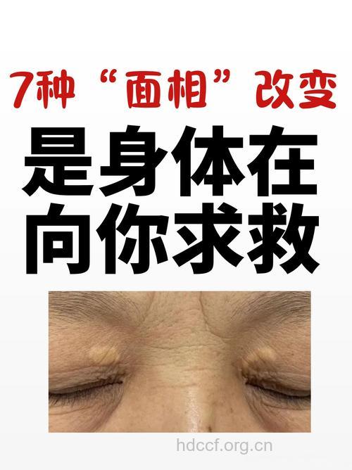 中医能够改变你容颜缺陷