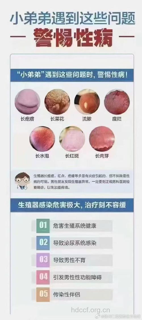 六种与男人相关的妇科疾病
