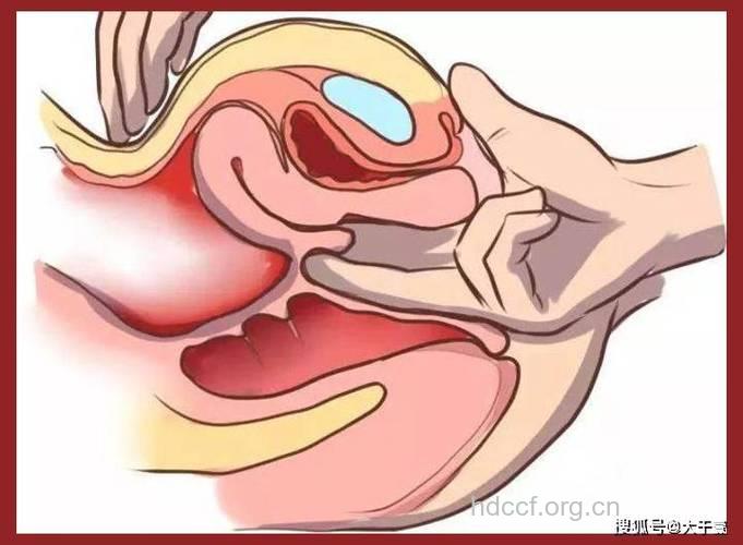 女性阴道“保湿”的六个方法