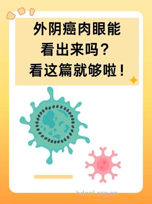 女性如何自我发现外阴癌