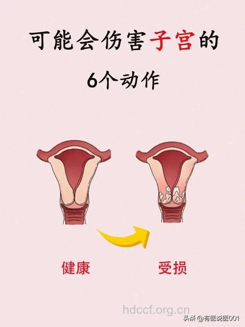 伤害子宫的十大危险性行为