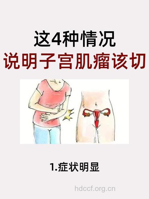 子宫肌瘤的早期信号