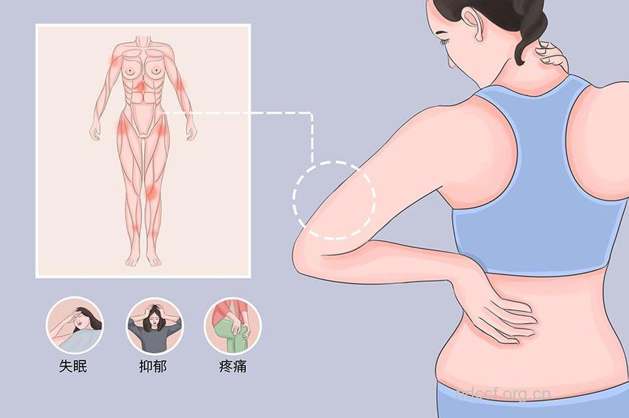 中年女性要谨防纤维肌痛