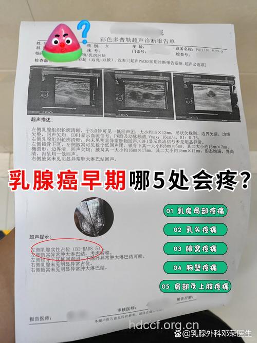 诊断乳腺癌只要45分钟