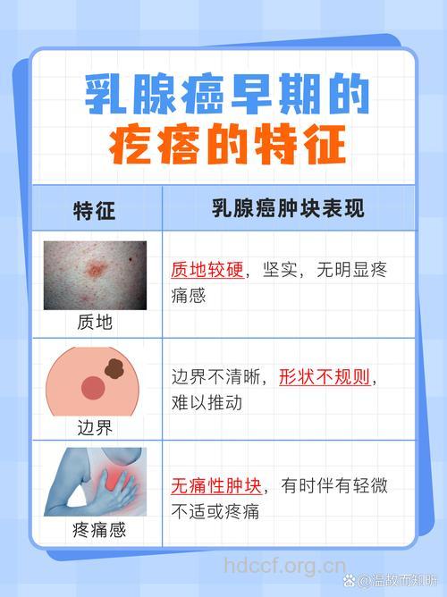 女性常便秘当心乳腺癌