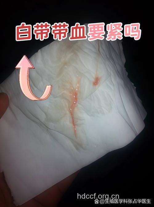 白带带血可能预示6种疾病